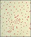 Una fotomicrografía de las bacterias de la tos ferina Bordetella (Haemophilus) pertussis que utiliza la técnica de la tinción de gram.