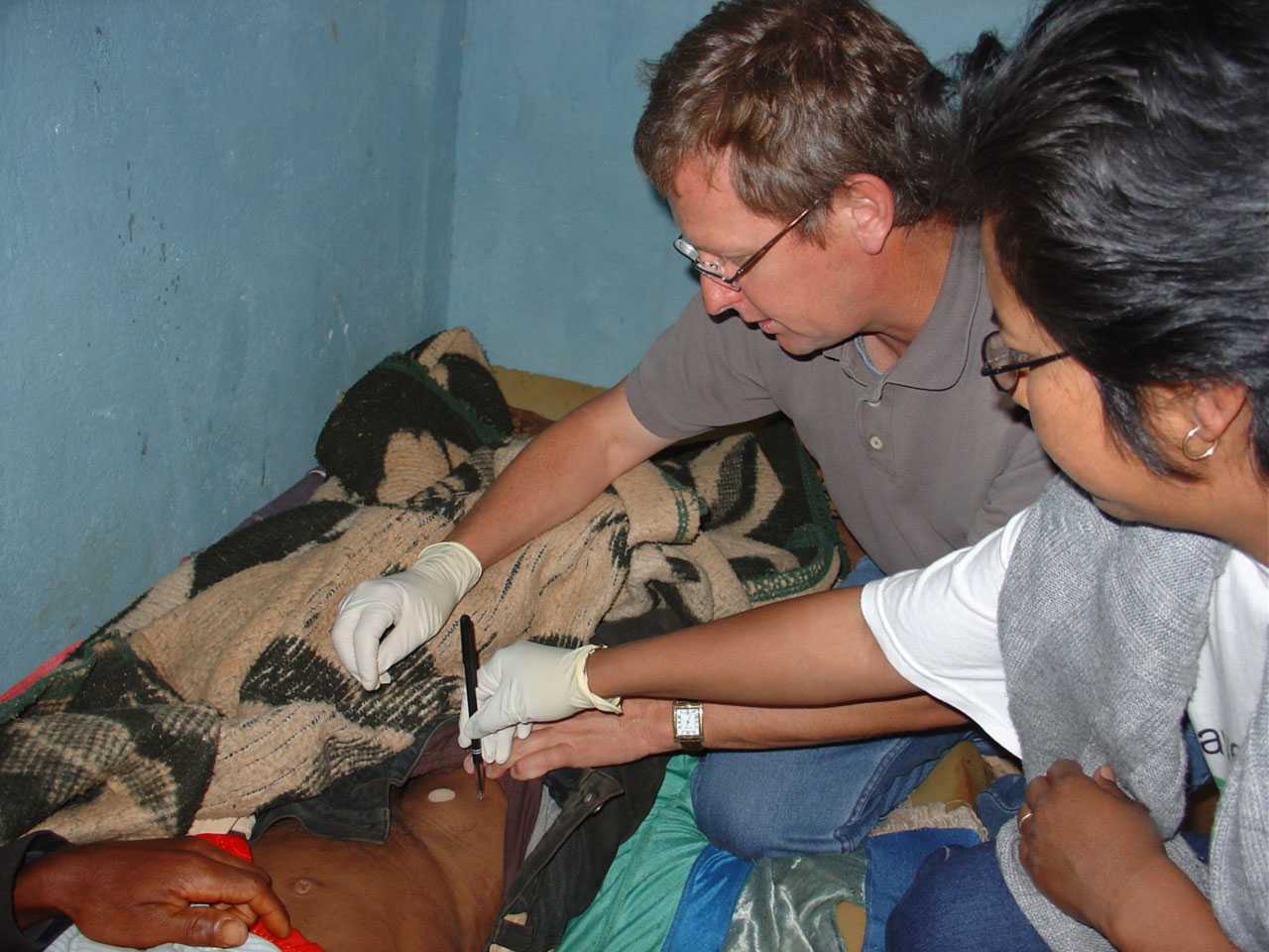 Doctors examining a bubo caused by plague.