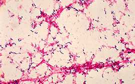 Photomicrograph of Streptococcus pneumoniae bacteria having been grown from a blood culture