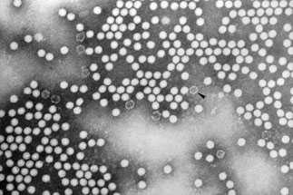 Electron micrograph of the poliovirus