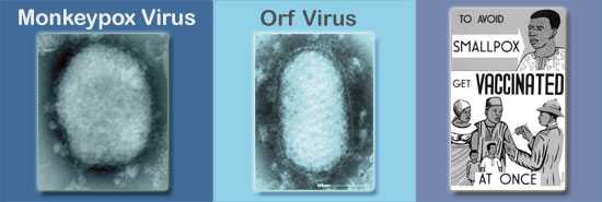 Image of monkeypox and orf viruses and a smallpox poster. 