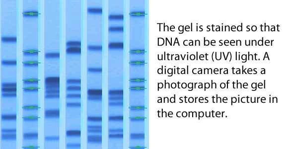 Graphic: The gel is stained so that DNA can be seen under ultraviolet (UV) light. A digital camera takes a photograph of the gel and stores the picture in the computer.
