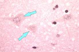 Microscope image of neuron without negri bodies