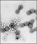 This electron micrograph reveals a number of RNA rotavirus virions, and a number of unknown, 29nm virion particles.