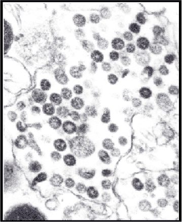 Image of the SARS Coronavirus