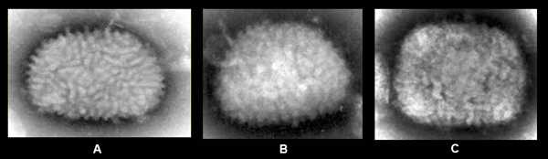 Figure 3:3-A: EM of vaccinia virus from tissue culture. 3-B: EM of vaccinia virus from clinical specimen. 3-C: EM of monkeypox virus from clinical specimen.