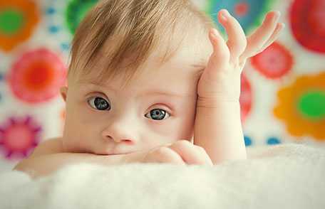 Bebé con síndrome de Down