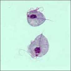 Dos parásitos Trichomonas vaginalis, amplificados (observados a través del microscopio)