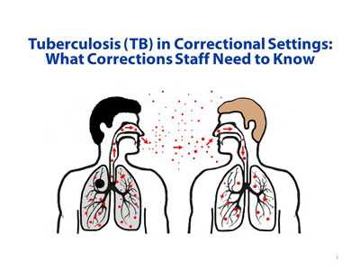 What Corrections Staff Need to Know slide set is designed to be used by health department staff to educate correctional facility staff on TB treatment and control efforts. Please use the facilitator guide to adapt the slide set to meet the needs and regulations of your jurisdiction.
