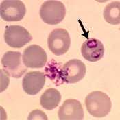 image of a blood smear showing Babesia parasites in red blood cells