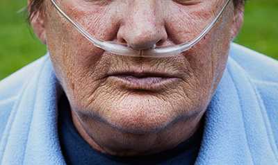 Man receiving oxygen therapy