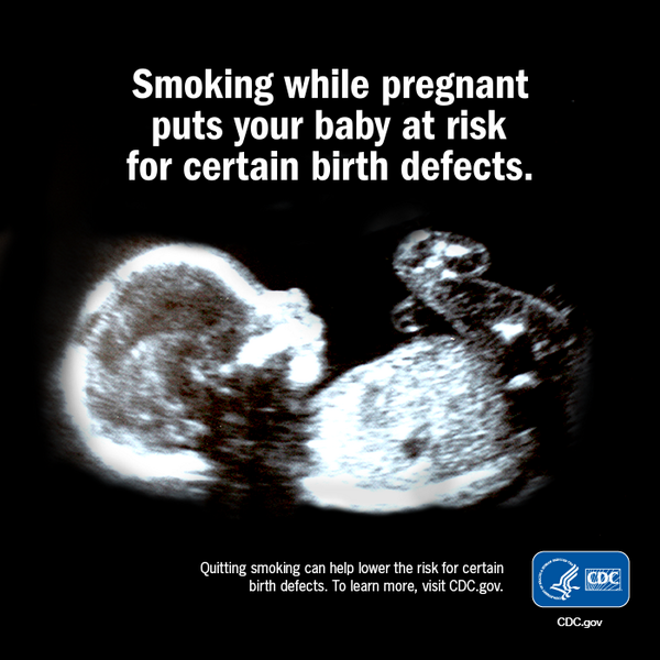 Smoking while pregnant puts your baby at risk for certain birth defects. Quitting smoking can help lower the risk for certain birth defects. To learn more, visit CDC.gov