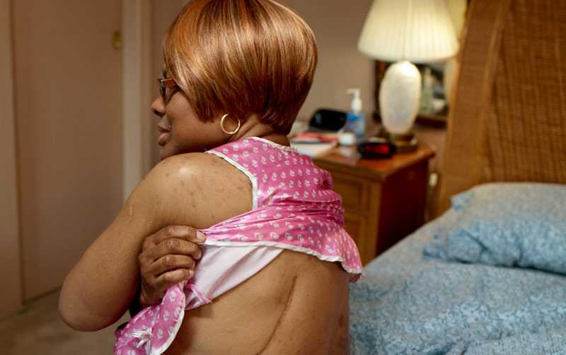 Annette, 57 años, Nueva York; se le diagnosticó cáncer de pulmón a los 52 años. 
