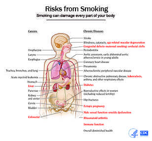 The health consequences causally linked to smoking