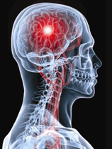 illustration of a traumatic brain injury