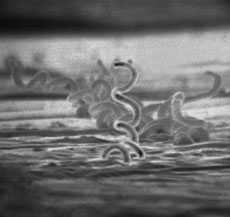 syphilis seen through electron microscope