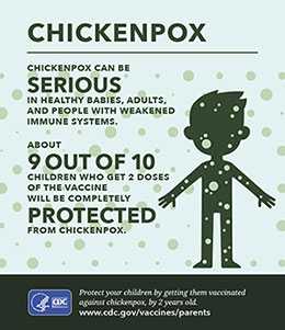 Small infographic showing the facts about chickenpox and how to protect your child.