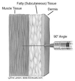 image of injection through dermis, fatty tissue, into muscle tissue at 90 degree angle