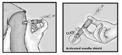 image of injection of prefilled microinfection syringe into arm showing click of the activated needle shield