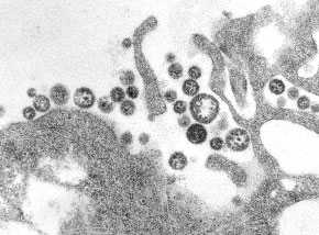 Photo d’un échantillon du virus de Lassa
