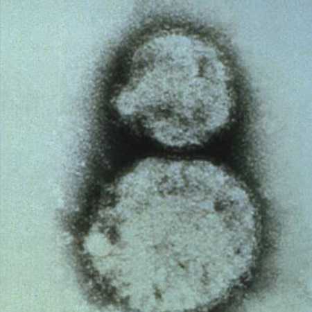Negatively stained transmission electron micrograph depicting Sin Nombre virus virions, belonging to the genus Hantavirus within the family Bunyaviridae.