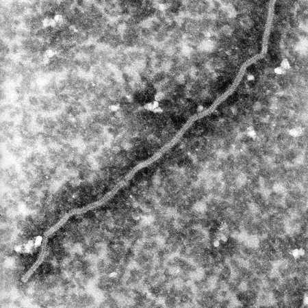 Transmission electron micrograph of Nipah virus nucleocapsid, in the Paramyxoviridae family of viruses.