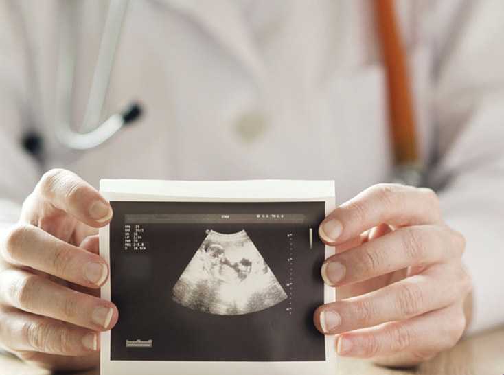 Graphic with photo of a physician holding an ultrasound photo on the right
