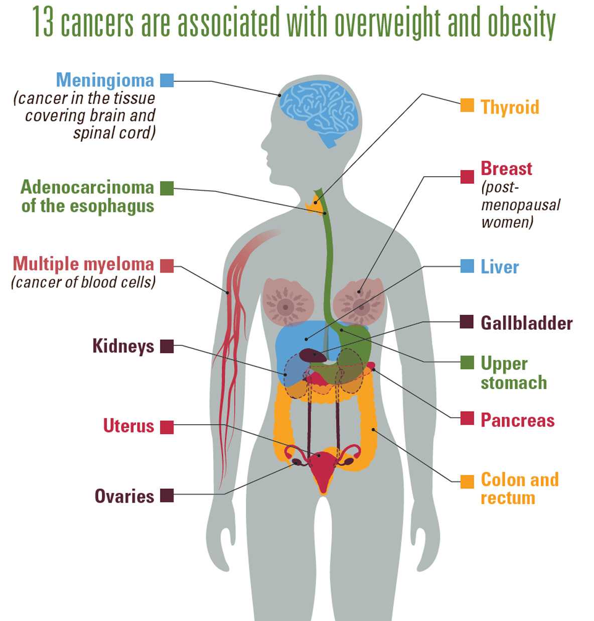 Graphic: 13 Cancers are associated with overweight and obesity