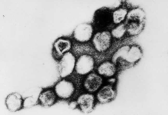 Transmission electron micrograph (TEM) depicts a number of rubella virons.