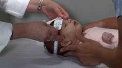 Medición de la cabeza de un bebé