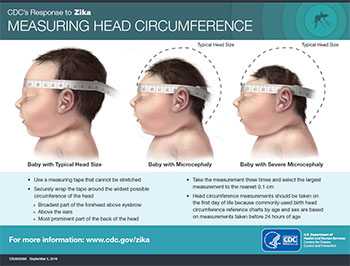 Measuring Head Circumference fact sheet thumbnail