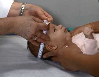 Measuring infant head circumference is a primary way to determine the presence of microcephaly.