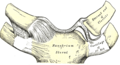 Sternoclavicular dislocation.png