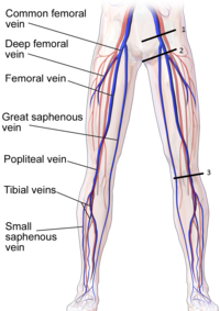 Compression of Lower Extremity Veins.png