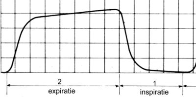 Typical waveform of a capnogram