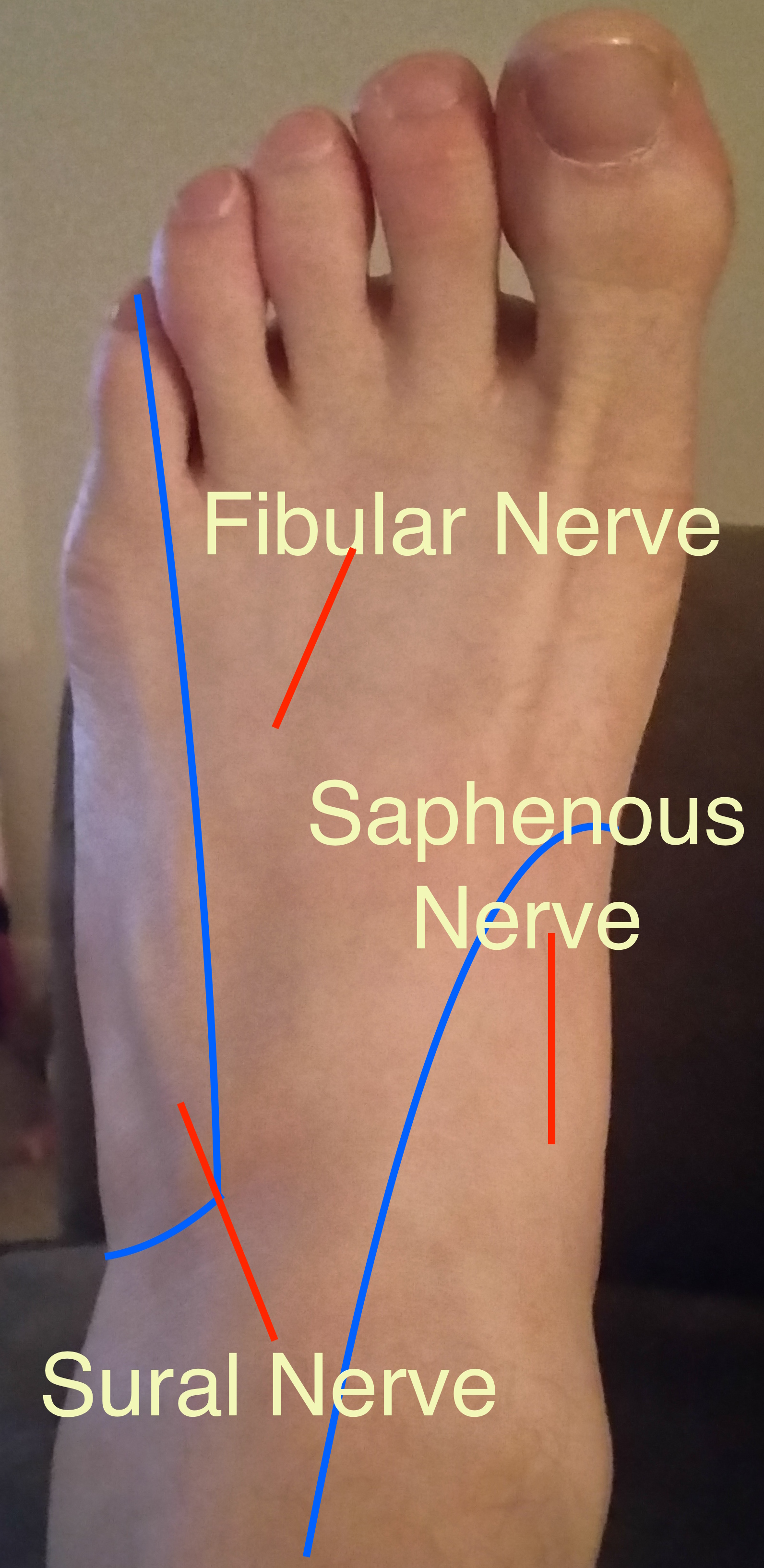 File Plantar Foot Nerve Distribution jpg WikEM