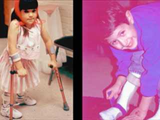 The Story of Folic Acid Fortification